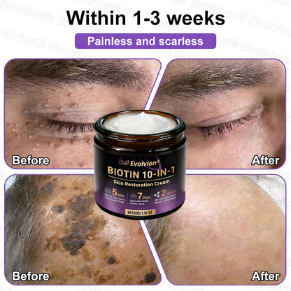 Made and Shipped from USA ✨Evolvion® Biotin 10-in-1 Skin Restoration Cream ✨