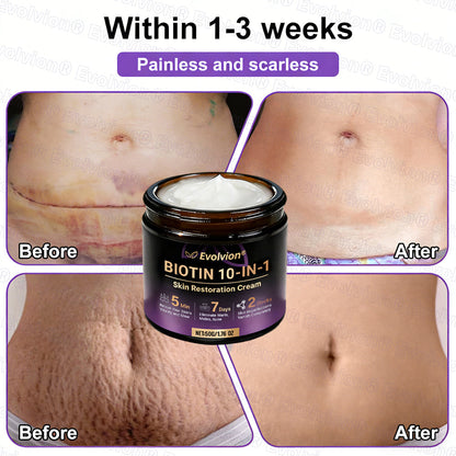 Made and Shipped from USA ✨Evolvion® Biotin 10-in-1 Skin Restoration Cream ✨