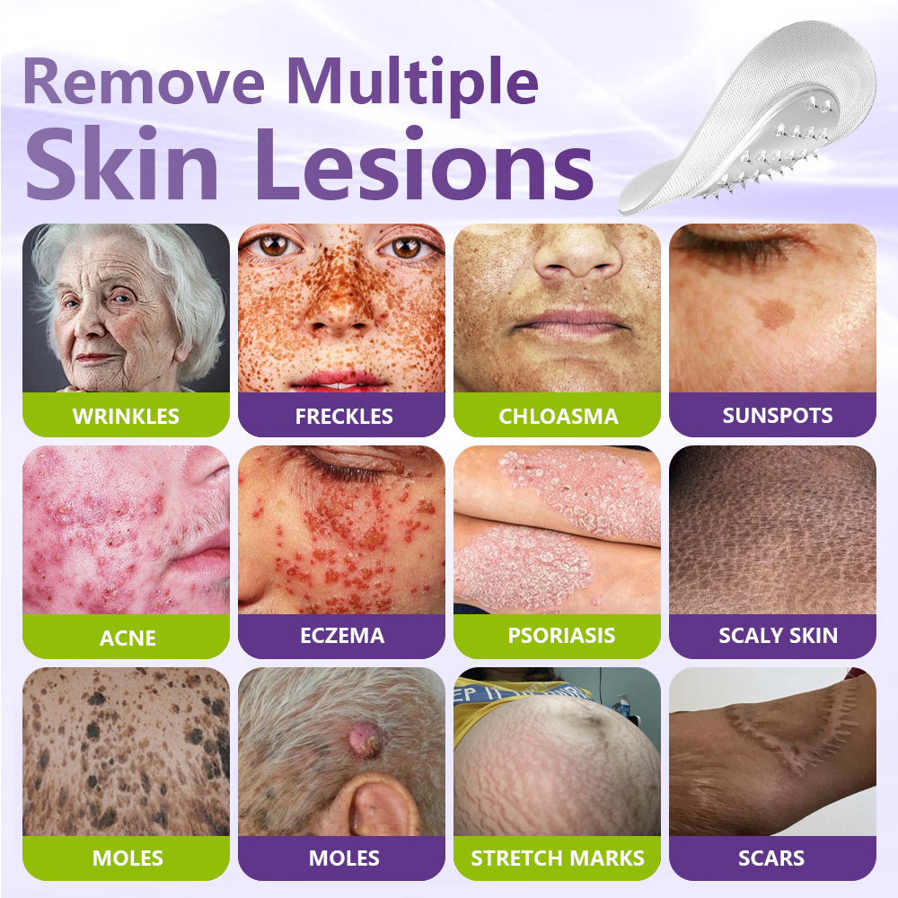GFOUK® Soluble Microneedle Botanical Skin Tag Removal Patch🎉🎉