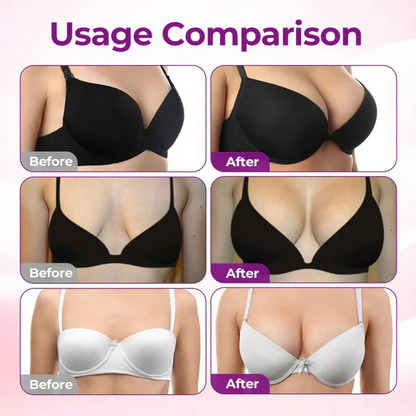 💥120K+ SOLD💕- Evolvion® Breast Enhance Mentmicroneedle Patch🪙