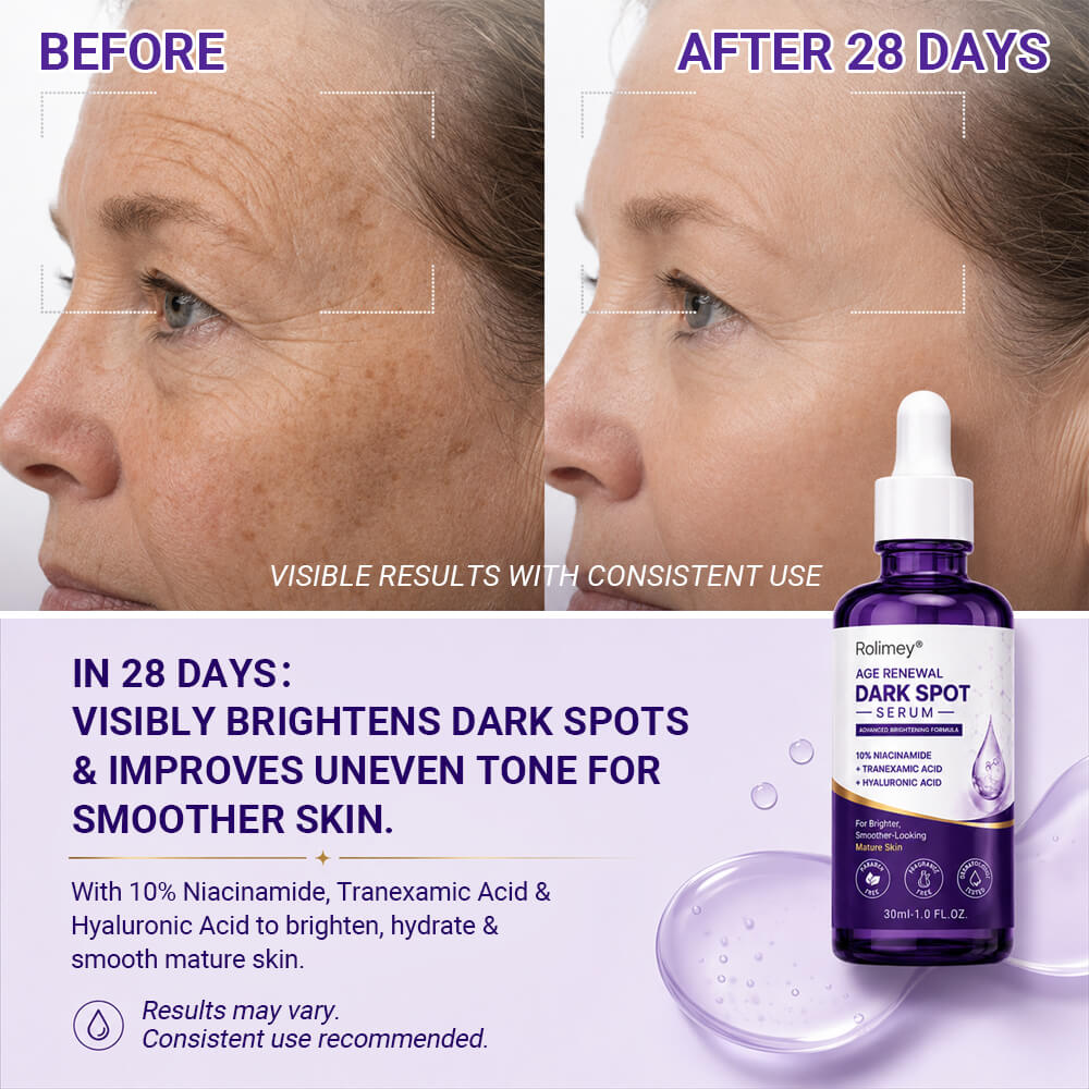 🍀 Rolimey® Age Renewal Dark Spot Serum — Infused with 10% Niacinamide, Tranexamic Acid & Hyaluronic Acid for Brighter, Smoother-Looking Mature Skin 🪙-up