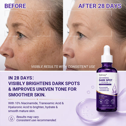 🍀 Rolimey® Age Renewal Dark Spot Serum — Infused with 10% Niacinamide, Tranexamic Acid & Hyaluronic Acid for Brighter, Smoother-Looking Mature Skin 🪙-up