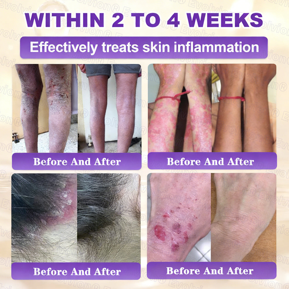 Made and Shipped from USA ✨Evolvion® Biotin 10-in-1 Skin Restoration Cream ✨