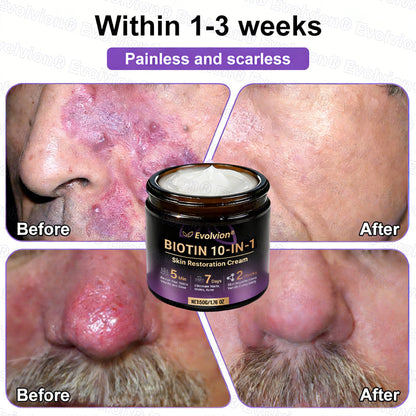 Made and Shipped from USA ✨Evolvion® Biotin 10-in-1 Skin Restoration Cream ✨