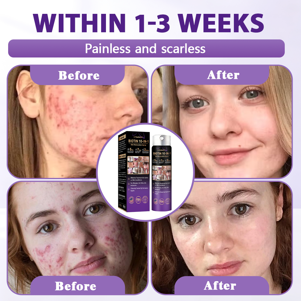 Made and Shipped from USA ✨Evolvion® Biotin 10-in-1 Skin Restoration Spray 🍀🍀