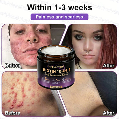 Made and Shipped from USA ✨Evolvion® Biotin 10-in-1 Skin Restoration Cream ✨